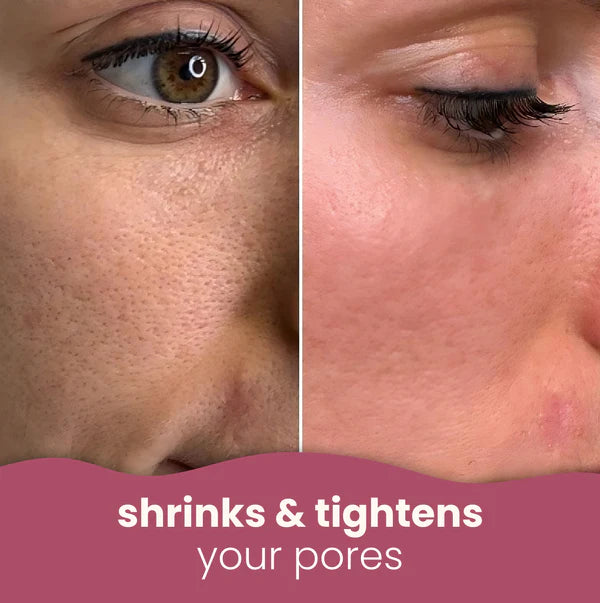 Brightening turmeric &amp; kojic acid pads