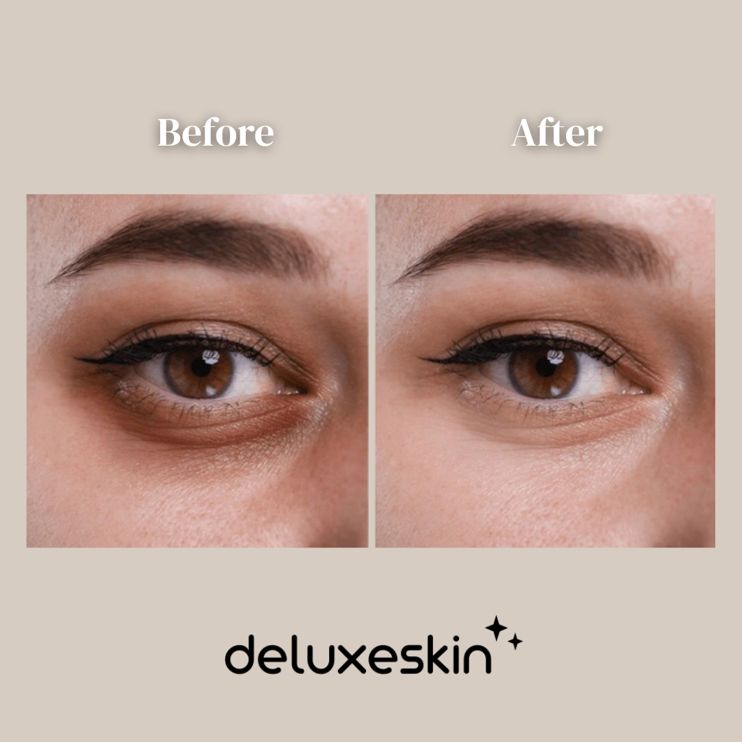 DeluxeSkin Under-Eye Light Therapy Device
