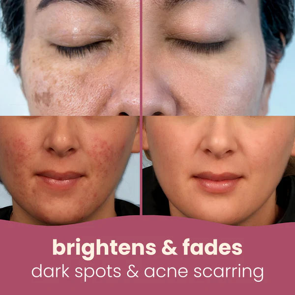 Brightening turmeric &amp; kojic acid pads